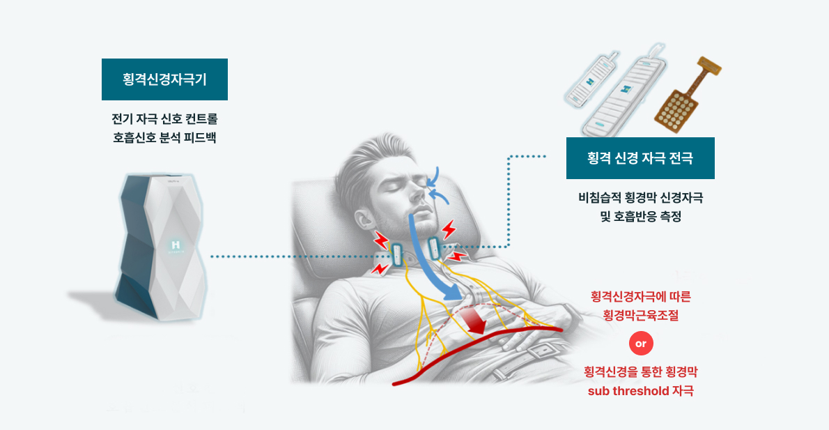 E-PURI 비침습적 횡격신경 전기자극 전자약