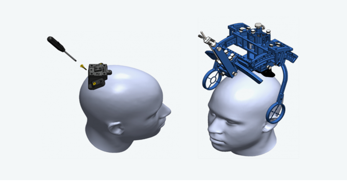 D1 Stereotatic Frame