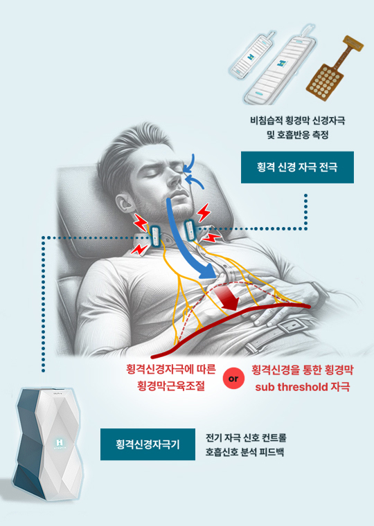 E-PURI 비침습적 횡격신경 전기자극 전자약